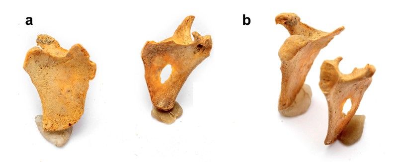 El síndrome de Down en la arqueología